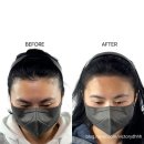 영헤어라인 이미지