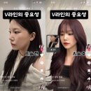 귀부인헤어 | 이마거상 흉터 치료, 거상흔적복원크림 부작용 극복 후기