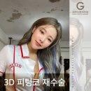 글로비성형외과의원 이미지