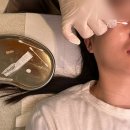 송정동 66-7 | 구미 피부에스테틱 뷰티샵 메리뷰티, 송정동 쥐젖 비립종 편평사마귀 제거 잘하는곳