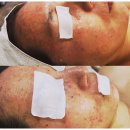 노원에스테틱 쁨단미에서 안정된 피부 되찾기