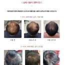 주식회사 탈모연구소 이미지