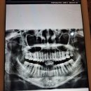 강인수양휘치과의원 | 강인수양휘치과 진짜 친절~^^ 사랑니 두번째 뽑는데 안아프다! 수정언니가 추천하고 댄스학원 같은 빌딩...