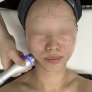 위플러스메디칼 | 투투맘 일상] 대구남구피부관리 '라플러스에스떼' 대명동 에스테틱에서 1:1 맞춤 케어 받고 온 힐링 후기 ✨