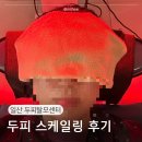 웰킨 산소 스케일링 후기 일산두피관리 탈모관리 센터