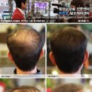 박준호탈모헤어센터 이미지