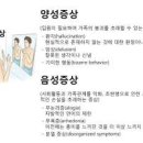 조현병 뜻 초기증상 원인 치료 방법 이미지