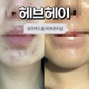 냉천2(안쪽) | 진해 갑분 성인여드름 박살내준 ‘헤브헤이’ 피부관리샵 리뷰