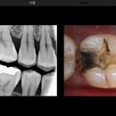 혼 치과기공소 이미지