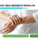 유대현나경선내과의원 | 류마티스 관절염 검사 과정: 증상에서 결과 해석까지