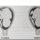 기초간호학(모성간호학) 임신5 이미지