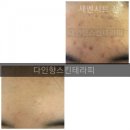 내몸의 단디 알아두어야 할 피부의 기관