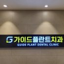 # 부천 원종동 가이드 플란트 치과 의원 _ 스케일링...및 크라운 마취 진료 및 치료 필요성 후기 일지 기록