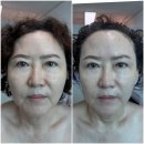 한빛나노메디칼 금천점 | 시흥동탈모관리 금천구두피관리 금천구체형관리/스마일부티끄