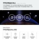 (리뷰) 청주 김안과 스마일라식 라섹 각막강화술 검사 후기 (1)
