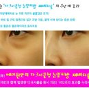 예미원피부과