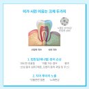 애터미행복파워센터 | 이가 시릴 때 쓰는 인생 치약! 애터미 이앤몸 치약 2주 사용 후기 (feat. 비회원 간편 구매 꿀팁)