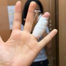 2도 | 심재성 2도 화상치료 후기 텅장을 곁들인 센텀화상치료