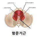 [아랫배항문통증] 비수술 신경치료후기