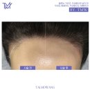 탈모왕 본점 이미지