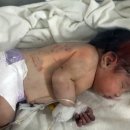 시리아 잔해 더미서 탯줄 달린 신생아 구조...“가족 중 유일한 생존자” 이미지