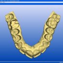 세라믹치과기공소 이미지