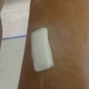 김메디컬의원 | 진피섬유종 제거ㅣ피지낭종제거ㅣ낭종, 섬유종 제거 병원 추천ㅣ성모항정유외과의원