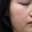 스킨새로이 | 엘라비에 리투오 모공 미백에 특히 좋다는 스킨부스터 후기