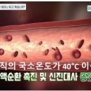 고주파 리페어 이미지