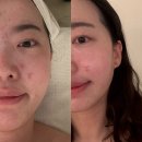 울산 ❘ 울산 삼산 피부관리 잘하는 ‘아름다운 차이’ ❘ 안면유지인대관리 후기