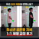 매홀중학교 | 오산 체형 교정 - 청소년 라운드숄더 굽은등 자세 교정 (before/after)