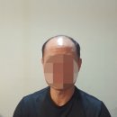 전주동안가발