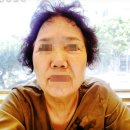 팔자실리프팅 후기 엄마 찐후기(어버이날 효도)