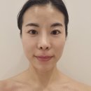 (주)폴라리스 | 폴라리스에스테틱 인퓨즈 글로우 리프팅2차 내돈내산 후기