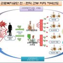 근로복지공단 산재승인은 ‘비리커넥션?’ 이미지