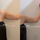 세연윤곽체형연구소 | [왕십리 슬리밍전문] 심미안연구소 VLT SPA E 팔&amp;액와 관리 후기