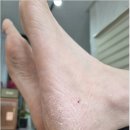 예쁜눈고운발