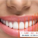 비나브이 이미지