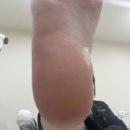 레푸스구미