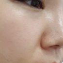 스피드메디 이미지