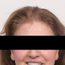 정원치과기공소 이미지