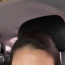 탈모샴푸 50대 여자 가르마 머리숱 두피 가려움 효과 후기