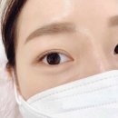 연신내 속눈썹펌 잘하는 리즈뷰티 찐후기(ft.콜드플라즈마)