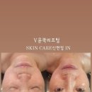 스킨케어신현정IN 네이버블로그