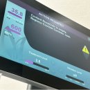 유앤아이의원명동점 | [피부관리] 유앤아이명동점 써마지 600샷 만족도 떨어진 시술 후기