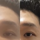 수피아 스킨앤바디 | 세종 조치원 피부관리 모공 블랙헤드 포함 통합 케어 솔직 후기〃수피아스킨앤바디