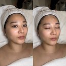 로데르뷰티 | 광주 신창동 피부관리 전문샵 로데르뷰티 첫방문 솔직 후기