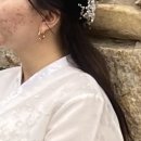 체인지의원 | [수원 망포] 톤즈의원 쥬베룩 스킨 4cc 2회차 후기