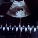 여성원한의원 | 목포남악진도해남 계류유산 중후기유산 소파수술, 임신중절수술후 자궁을 튼튼하게 자궁건강 회복하세요