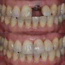 서울산성플란트치과의원 이미지